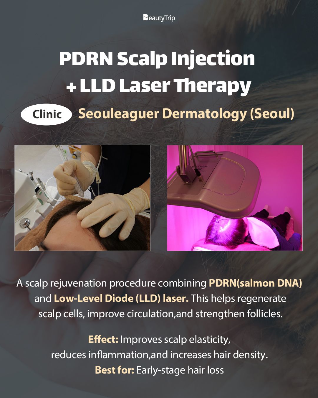 glutathione deficiency diseases Glutathione Injections in Gangnam-gu, Seoul, Korea main image 0